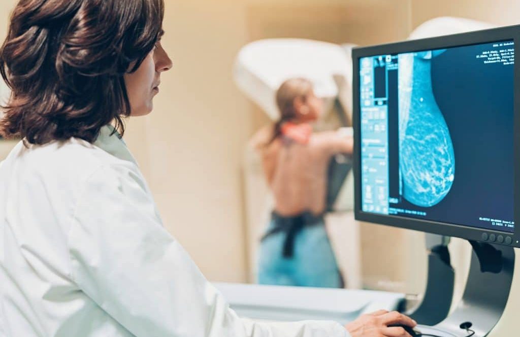 Mamografia e seus avanços no tratamento contra o Câncer no Brasil