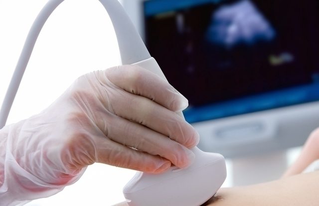 O que é ultrassonografia, para que serve, tipos que a Medimagem oferece